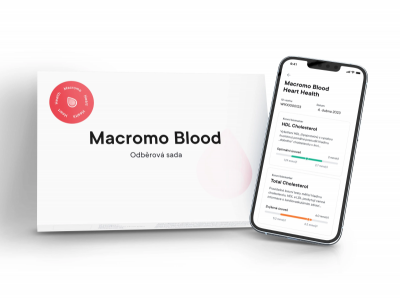 Macromo Krevní test Zdravá játra